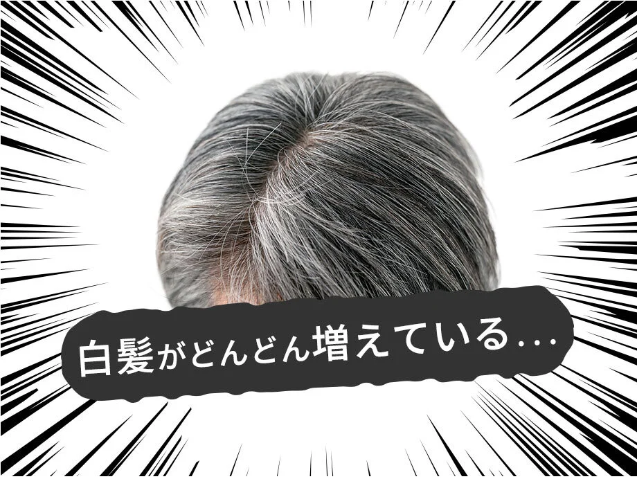 白髪がどんどん増えている…