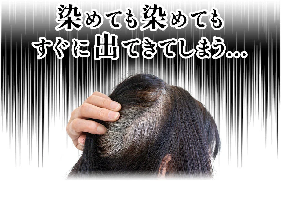 染めても染めてもすぐに出てきてしまう…